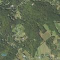 72-year-old woman with drain tube issue on Bunker Hill Rd