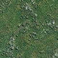 60-year-old man with breathing difficulty on home oxygen