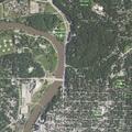 Man with abnormal breathing and abdominal pain in Iowa City