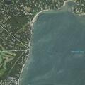 Person with possible dislocated hip at Brewster care center