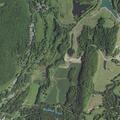 89-year-old woman with uncontrollable nosebleed in Wassaic