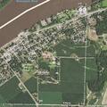 67-year-old woman with abdominal pain and vomiting at mobile home