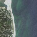 Surfer falls in water with rib pain at Nauset Beach