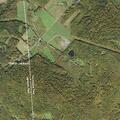 Woman suffering vomiting and abdominal pain in Thompson