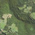 75-year-old man with breathing difficulty at Moody Hollow