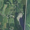 59-year-old man with abnormal breathing in Millerton