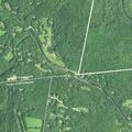 Male patient bleeding from trach site in Barkhamsted