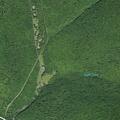 36-year-old man with abdominal pain in Shandaken