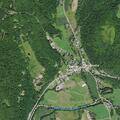 52-year-old man with abdominal pain in Bloomville