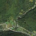 19-year-old female with chest pain in Richford