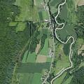 75-year-old man with heart problems treated at Mt Upton