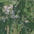 66-year-old man with testicular and chest pain in Greenville
