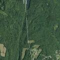 74-year-old man with abdominal pain at County Route 111