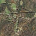 65-year-old man with left-sided numbness in Shelburne Falls