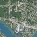 Patient with kidney stones near State Street in Algonac