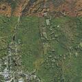 Teen male hemorrhaging after tonsil surgery in Ashburnham