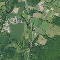 66-year-old woman passing kidney stone in Cooperstown