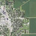 76-year-old woman falls with possible hip dislocation