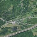 77-year-old woman with bowel obstruction at Duanesburg Rd
