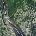 57-year-old woman with abdominal pain in Cohoes