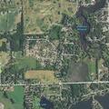 62-year-old man falls and has breathing difficulty