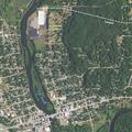 65-year-old woman with abdominal pain in Lowell