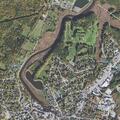 24-year-old woman with abdominal pain at Columbia Park