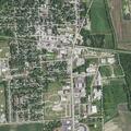Man suffering pain from kidney stones in Imlay City