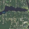 Three-year-old girl post-seizure at Green Oak Street