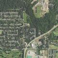 99-year-old man falls with hip injury at assisted living