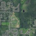 82-year-old male shows stroke symptoms in Penfield