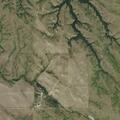 Postpartum woman reports severe abdominal pain east of Kyle