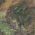 55-year-old male falls and suffers serious head bleed