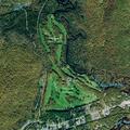 73-year-old male unresponsive but breathing at golf club