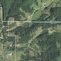 70-year-old female with numbness and vomiting in Wisconsin