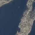 Patient with burn needs dressing change at Harpswell Island