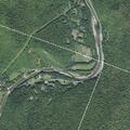 75-year-old man having difficulty breathing in Vermont