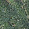73-year-old woman short of breath after cardiac surgery