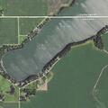 Elderly woman with leg numbness and vomiting at Fish Lake