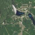 71-year-old man with abdominal pain in Lake, MI