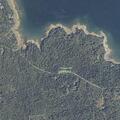 71-year-old woman with severe leg cramps in Deer Isle