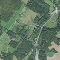 79-year-old man with severe edema near East Montpelier