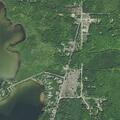 Person passing heavy blood due to GI bleed at Peninsular Shores
