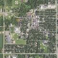 Woman with chest pain and heart failure symptoms in Farmington