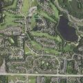 79-year-old man with fever and kidney failure in Prior Lake