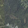Woman in lupus crisis with vomiting at campground