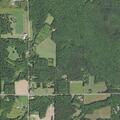 77-year-old woman with swollen painful legs in Mosinee