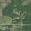 Woman accidentally pulls out kidney drain tube