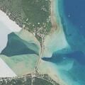 87-year-old woman falls and needs lift assist at home