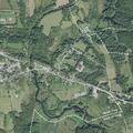 Woman aged 48 has severe breathing difficulties